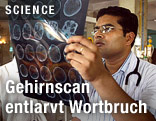 Ein Arzt sieht sich einen Gehirnscan an