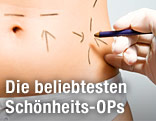 Angezeichneter Bauch