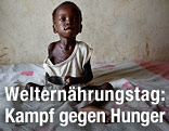 Kind mit leerer Sch&uuml;ssel