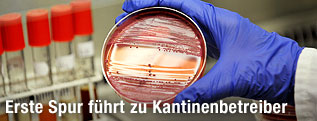 Hand in Gummihandschuh mit Bakterienprobe