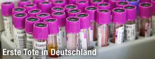 Urinproben im Labor
