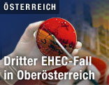 EHEC-Proben in einem Labor