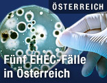 Hand in Gummihandschuh mit Bakterienprobe