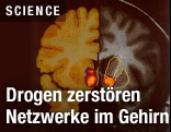 Scans von Gehirn unter Drogeneinfluss
