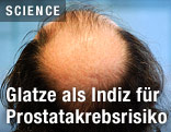 Mann mit Glatze von oben