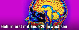 Scan eines menschlichen Gehirns