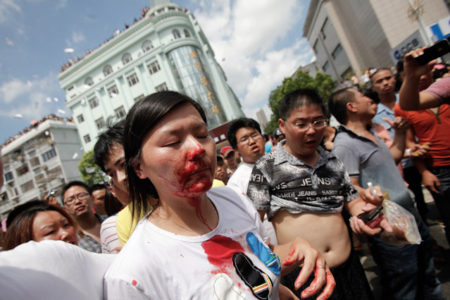 © Reuters/Carlos Barria Verletzte Demonstrantin Qidong