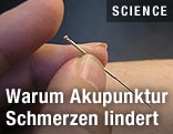 Akupunkturnadel