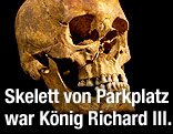 Schädel von König Richard III.