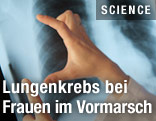 Röntgenaufnahme