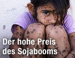 Ver&auml;ngstigtes M&auml;dchen