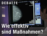 Mammographie