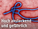 Ebola-Virus