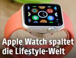 Apples iWatch
