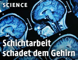 Magnetresonanztomographie eines menschlichen Gehirns