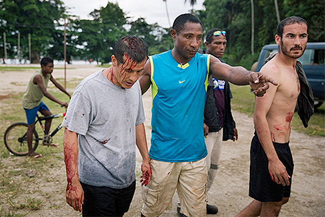 © APA/AFP/Matthew Abbott Verletzte Flüchtlinge auf Manus