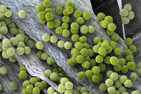 Miskroskopaufnahme von Ragweedpollen