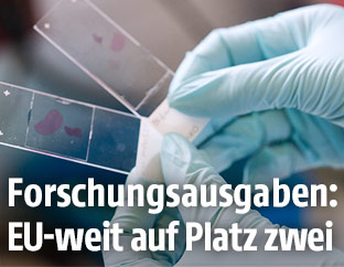 Laboranti mit Proben