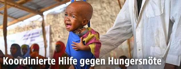 Ein weinendes somalisches Baby wird von einem Arzt gewogen