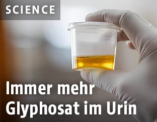 Urinprobe